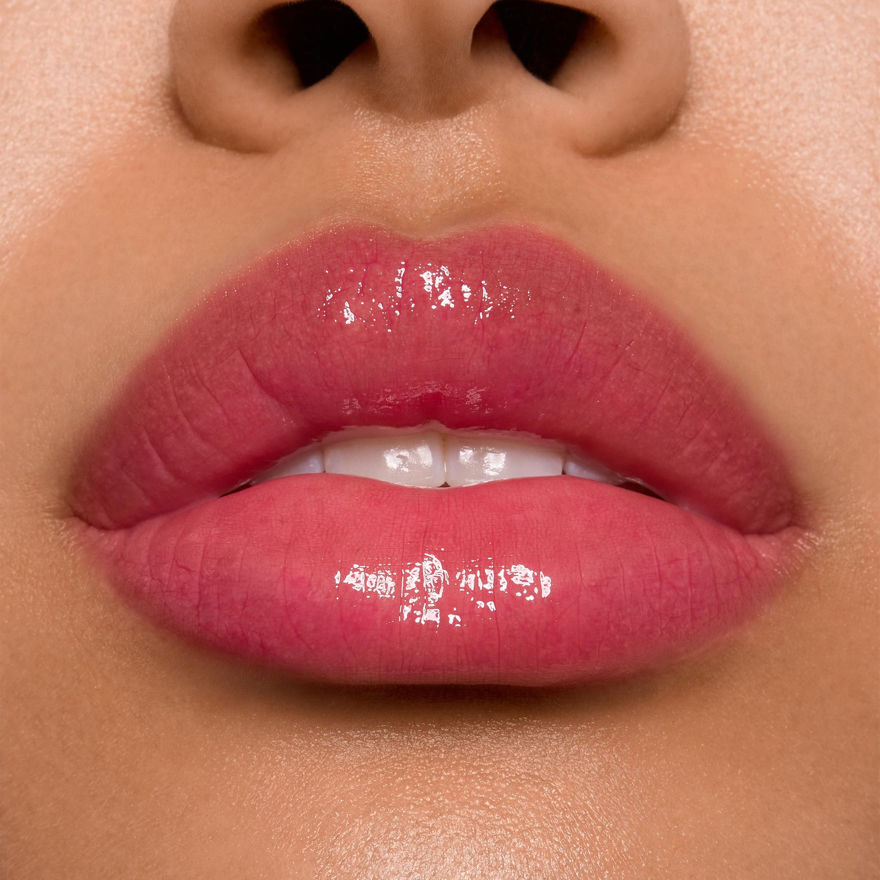 Surfer Vibes - Classic Pick